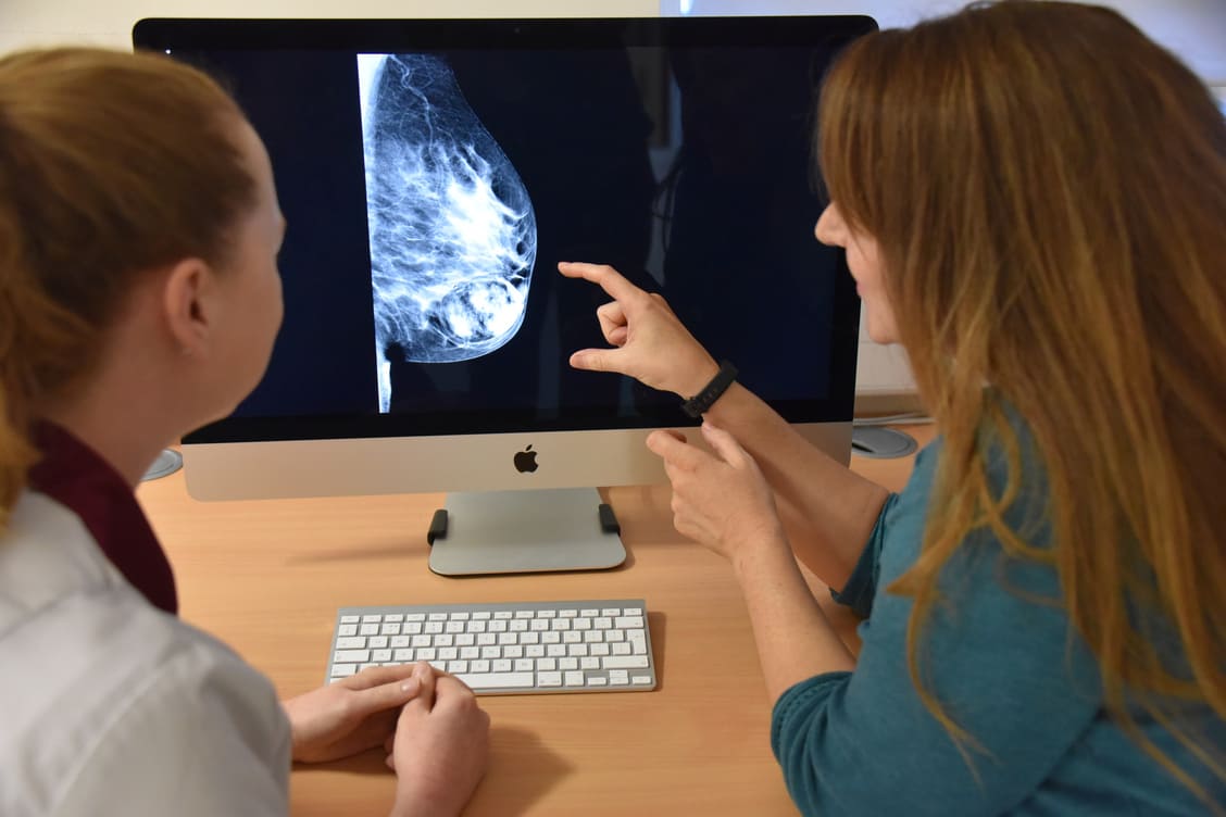 Assessors needed for Mammography Associate apprenticeships