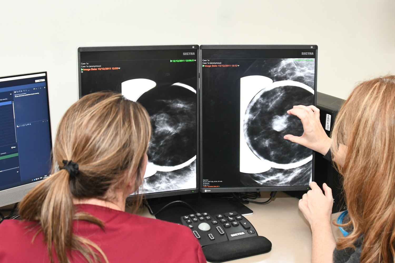 NBIA Fellowship Programme – Boosting breast imaging specialists for a better future